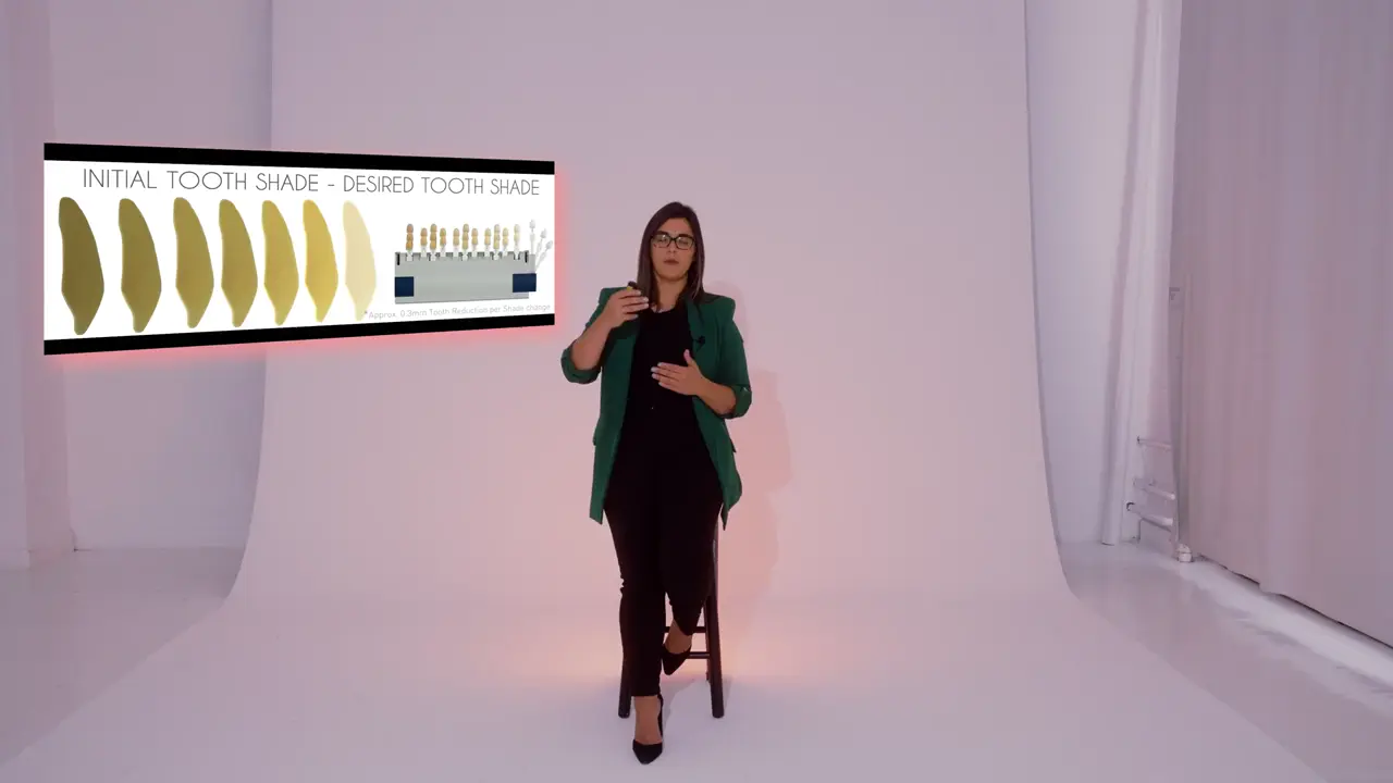 A Details lesson on lab communication: the initial tooth shade beside the desired tooth shade